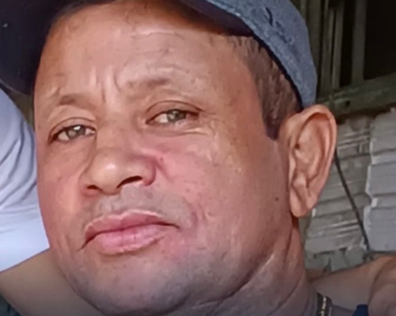 Vítima de tentativa de homicídio ocorrido em 2023 não resiste a complicações e morre